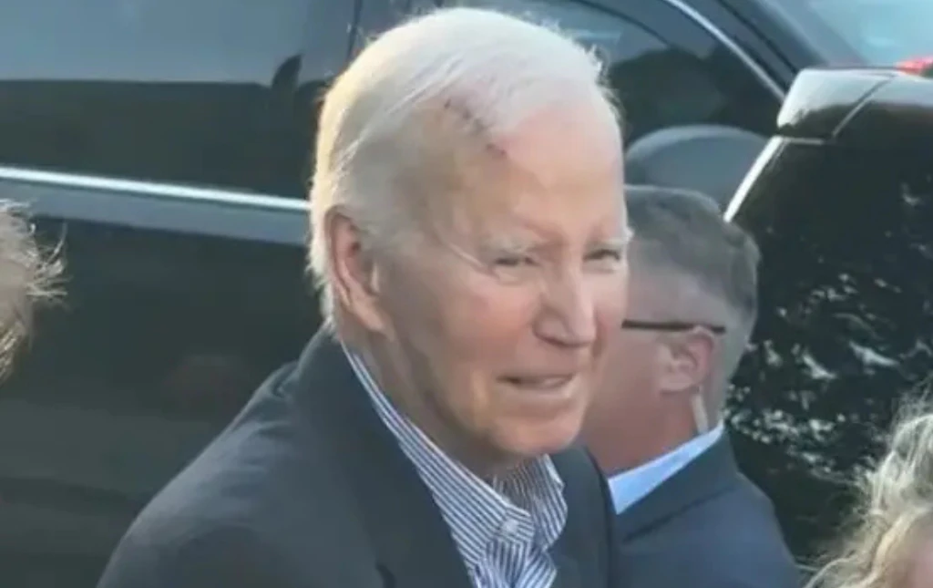 Joe Biden spokesperson confirms rumors after former US president was spotted with giant bandage on head