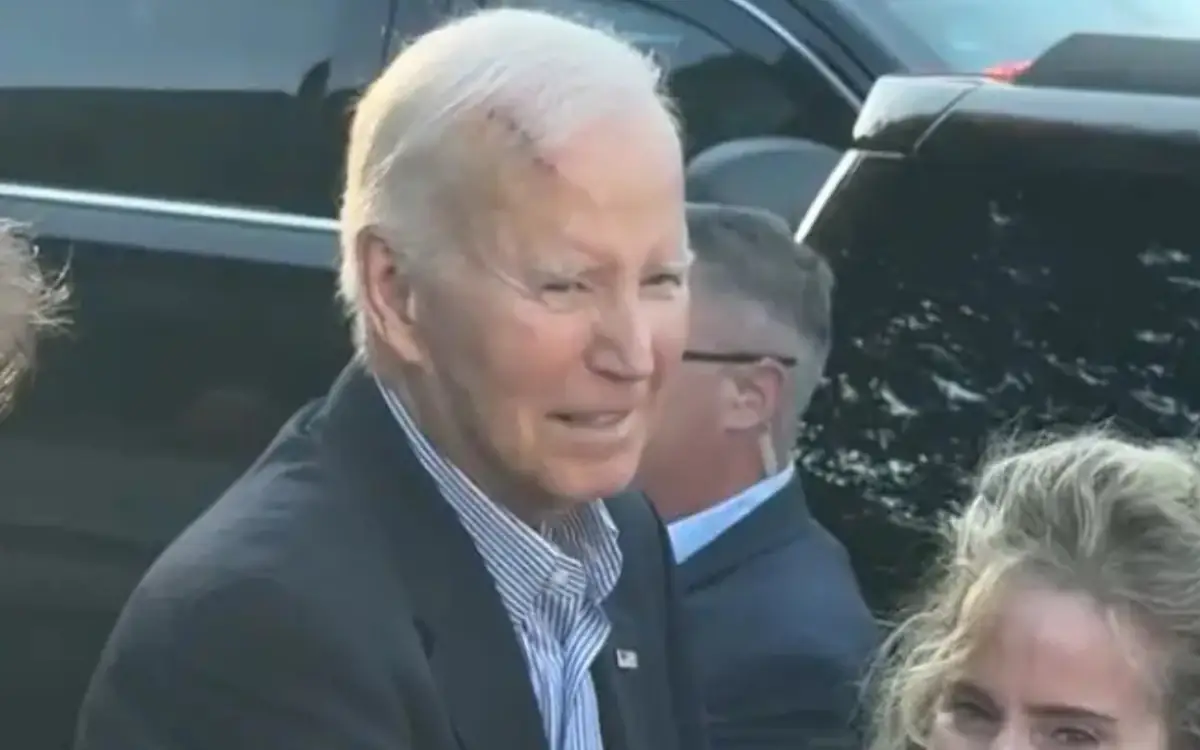 Joe Biden spokesperson confirms rumors after former US president was spotted with giant bandage on head