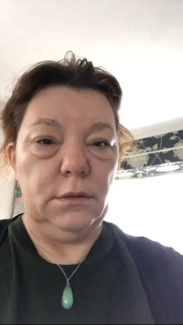 Lizzie’s first symptoms were bags under her eyes. Credit: Leukaemia UK