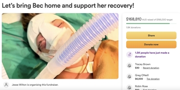 $100,000 raised for woman after mysterious accident leaves her with horrific facial injuries: 'No one knows what happened to her'