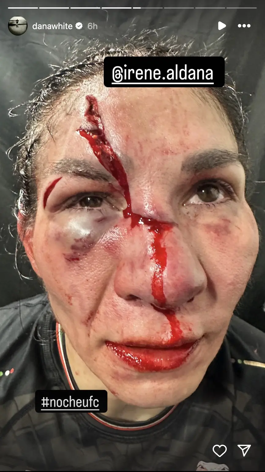 UFC boss Dana White shared a graphic pic of Aldana. Credit: Instagram/DanaWhite