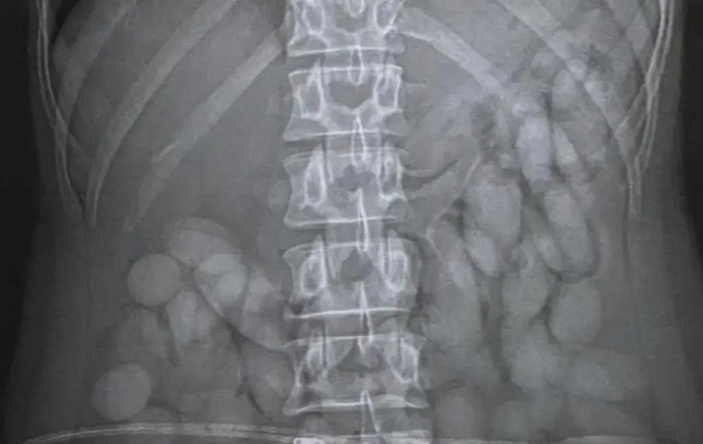 Passenger detained and arrested immediately after being x-rayed by airport security