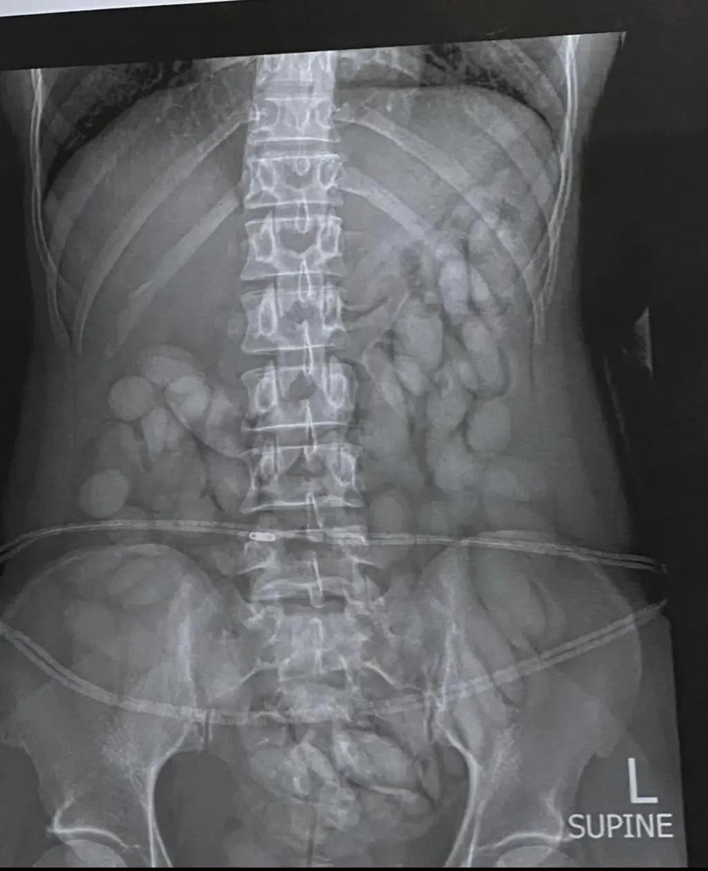The x-ray in question that led to the woman's arrest. Credit: South African Police Service