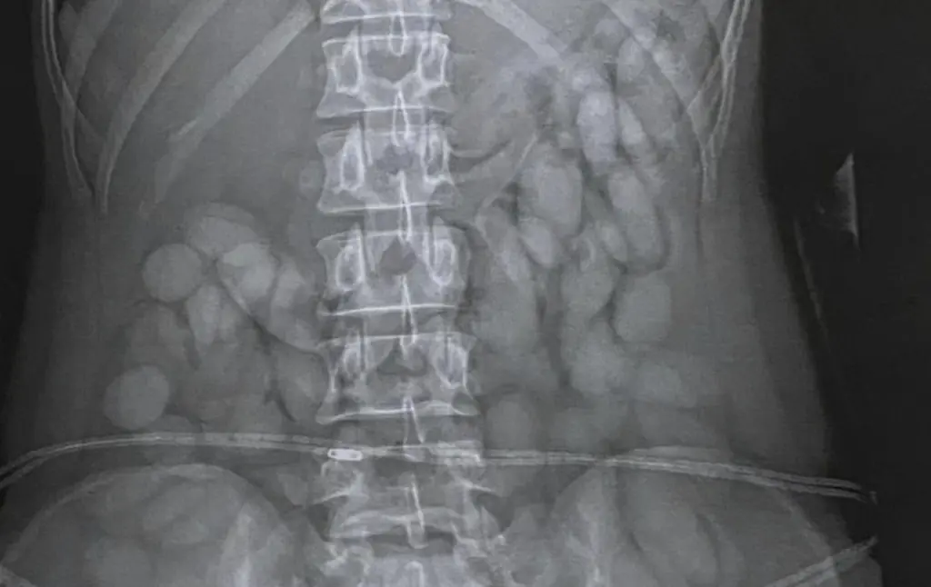 Passenger detained and arrested immediately after being x-rayed by airport security