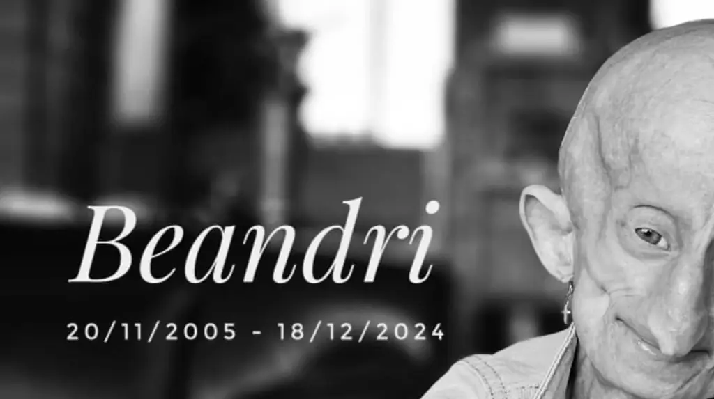 What is Progeria? As tributes pour in for TikTok star Beandri Booysen who has sadly died aged 19