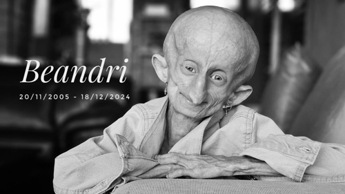 What is Progeria? As tributes pour in for TikTok star Beandri Booysen who has sadly died aged 19