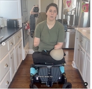 Mom who lost both arms and legs following traumatic birth shares advice to other pregnant women