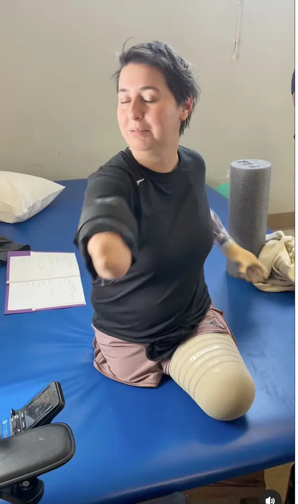 Brie has undergone months of physiotherapy after having all four limbs amputated. Credit: Instagram/Brieandbeau