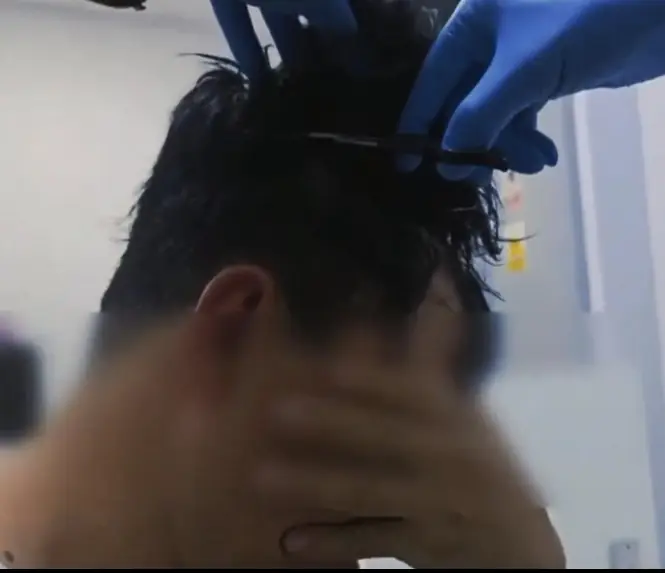 Man caught trying to smuggle cocaine under a wig - Article Image 1