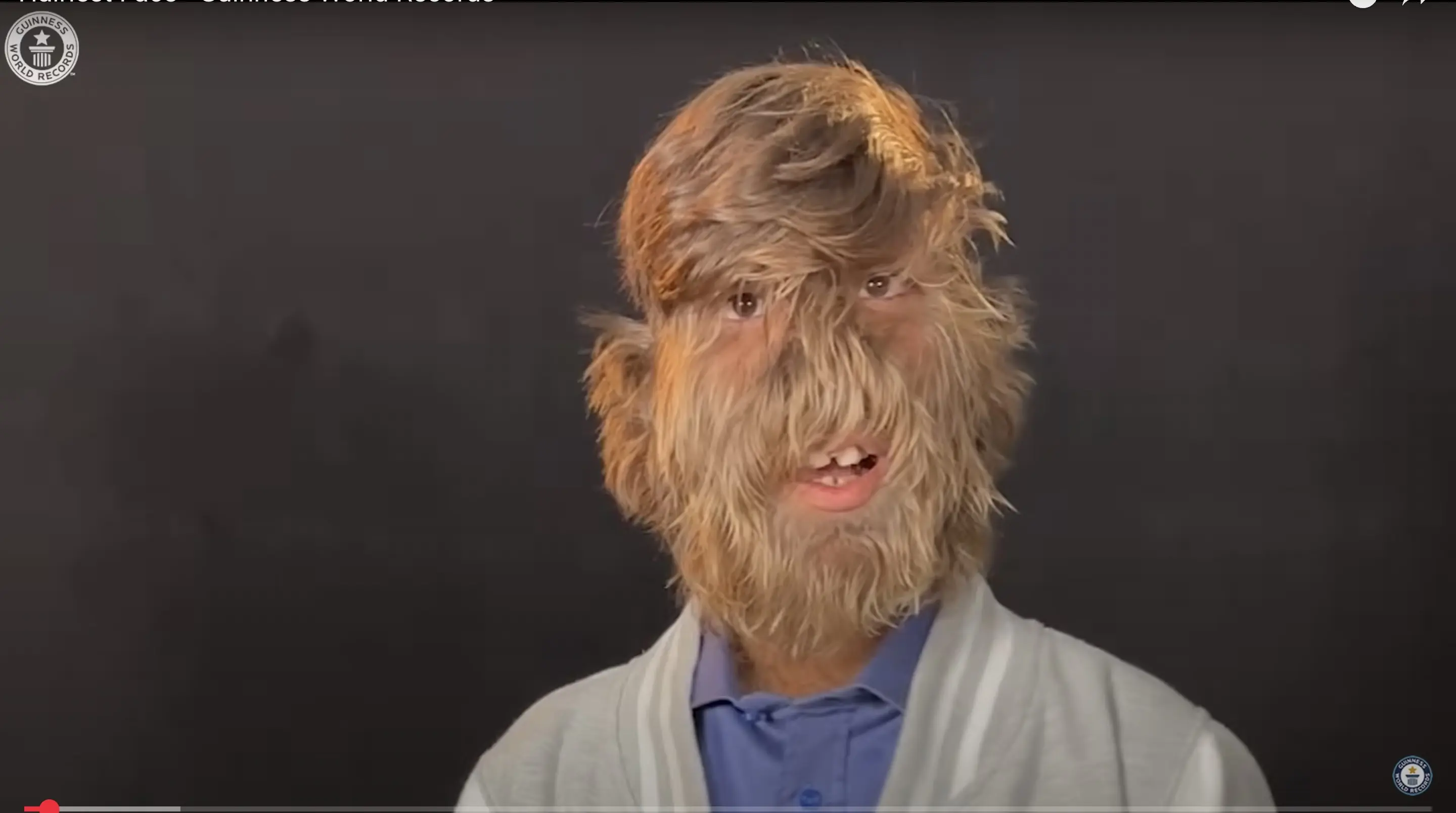 Lalit Patidar has been awarded the Guinness World Record for 'hairiest face on a person'. Credit: YouTube/Guinness World Records