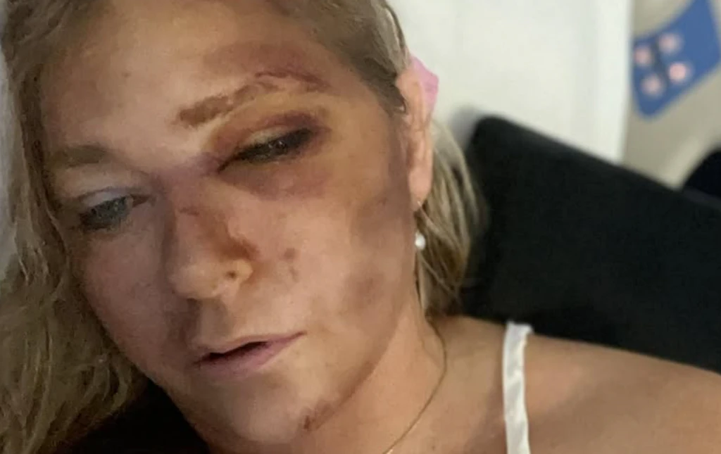 Police share new details as Prince Andrew accuser Virginia Giuffre says she has just 'days to live' following crash