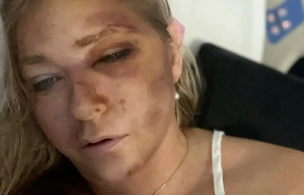 Virginia Giuffre's lawyer releases heartbreaking statement after she revealed she only has 'days left to live'