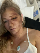 Police share new details as Prince Andrew accuser Virginia Giuffre says she has just 'days to live' following crash