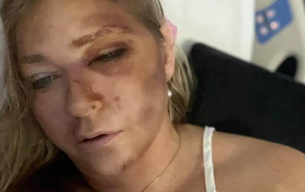 Police share new details as Prince Andrew accuser Virginia Giuffre says she has just 'days to live' following crash