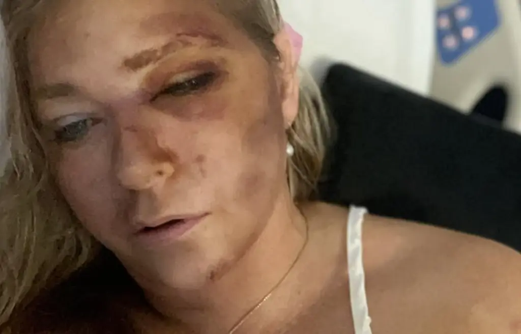Virginia Giuffre's lawyer releases heartbreaking statement after she revealed she only has 'days left to live'