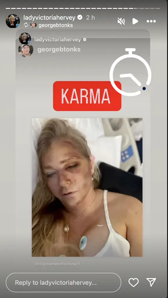 Prince Andrew’s ex reposted a photo of Giuffre lying bruised in a hospital bed with the caption “KARMA