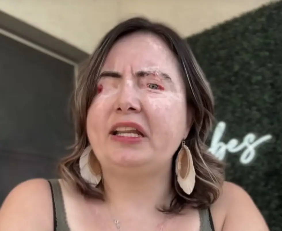 Woman says God allowed her to 'leave her body' as abusive husband poured chemicals into her eyes