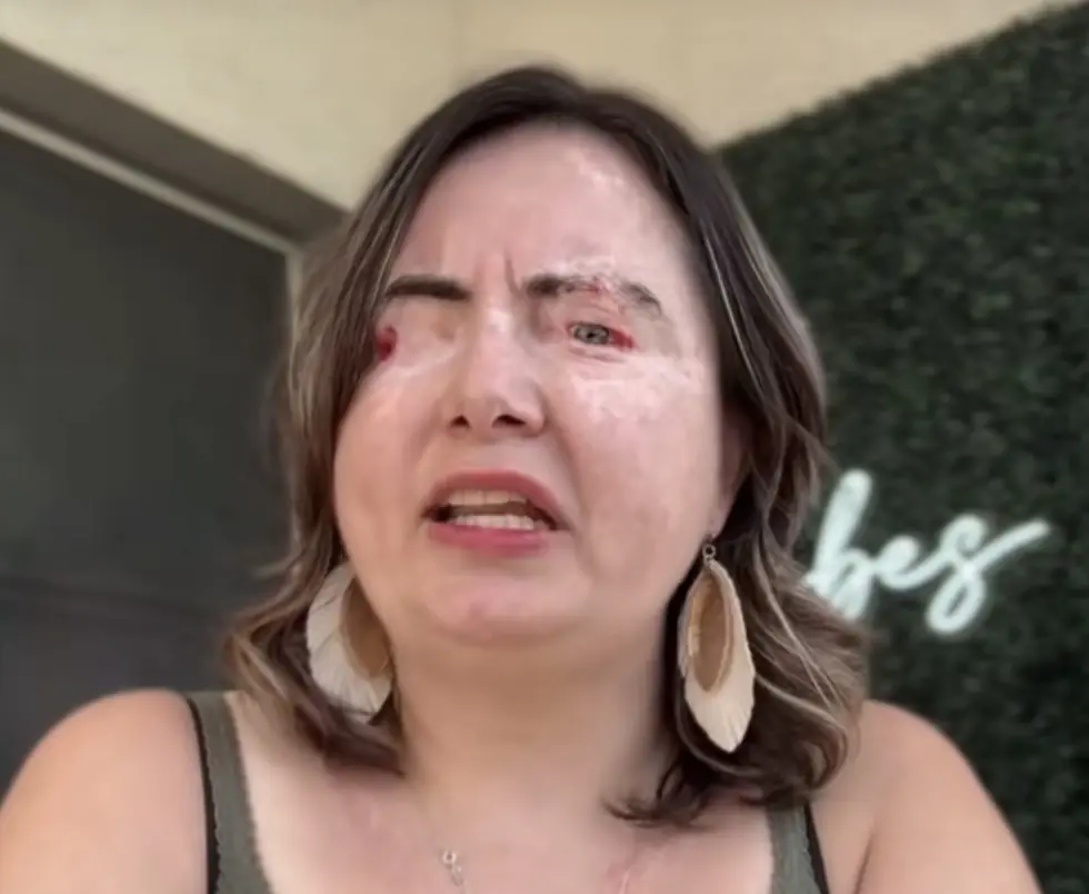 Woman says God allowed her to 'leave her body' as abusive husband poured chemicals into her eyes