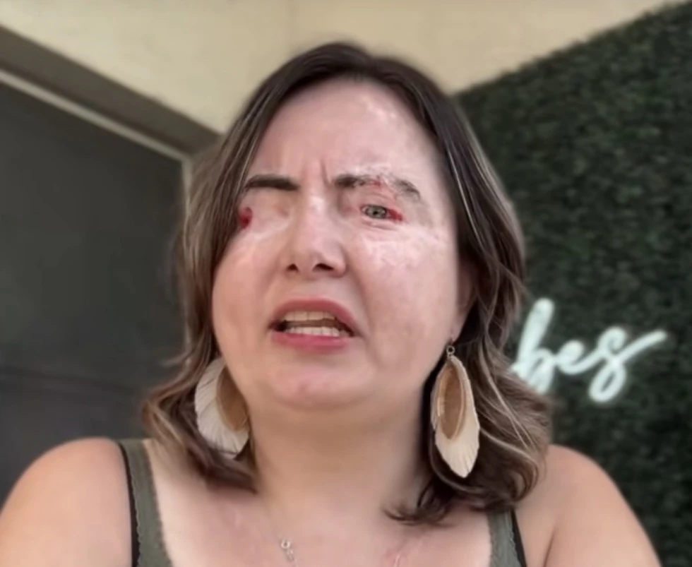 Woman says God allowed her to 'leave her body' as abusive husband poured chemicals into her eyes