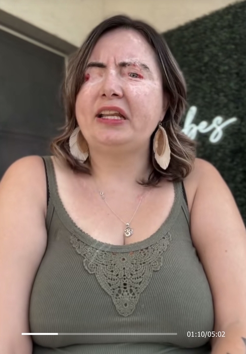 Woman says God allowed her to 'leave her body' as abusive husband poured chemicals into her eyes