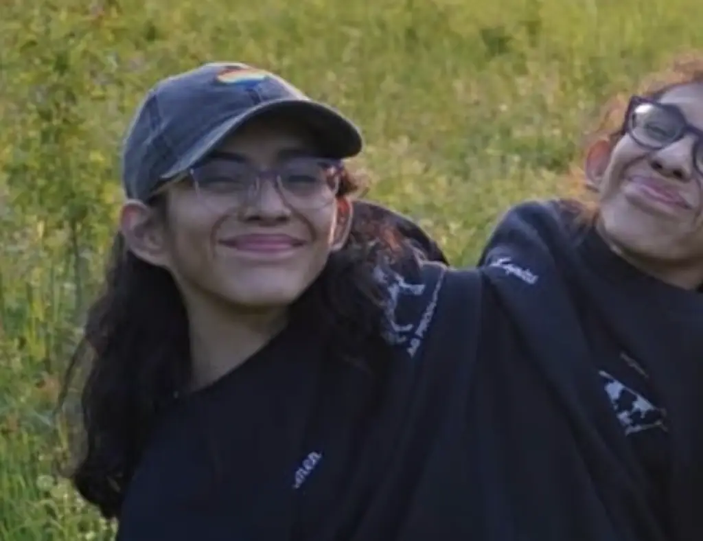 Conjoined twins reveal what would happen if one of them died