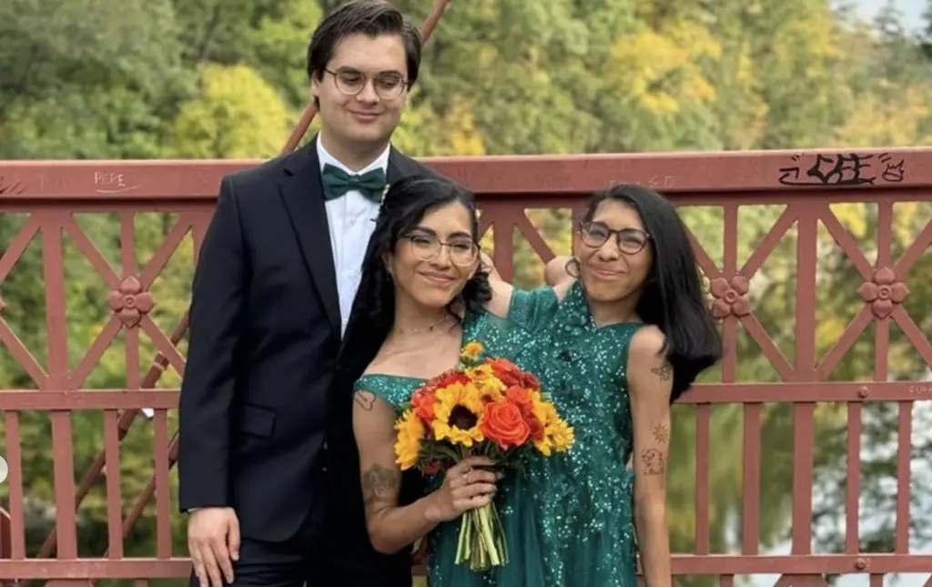 Conjoined twin influencer reveals surprise marriage to boyfriend: 'We eloped!'