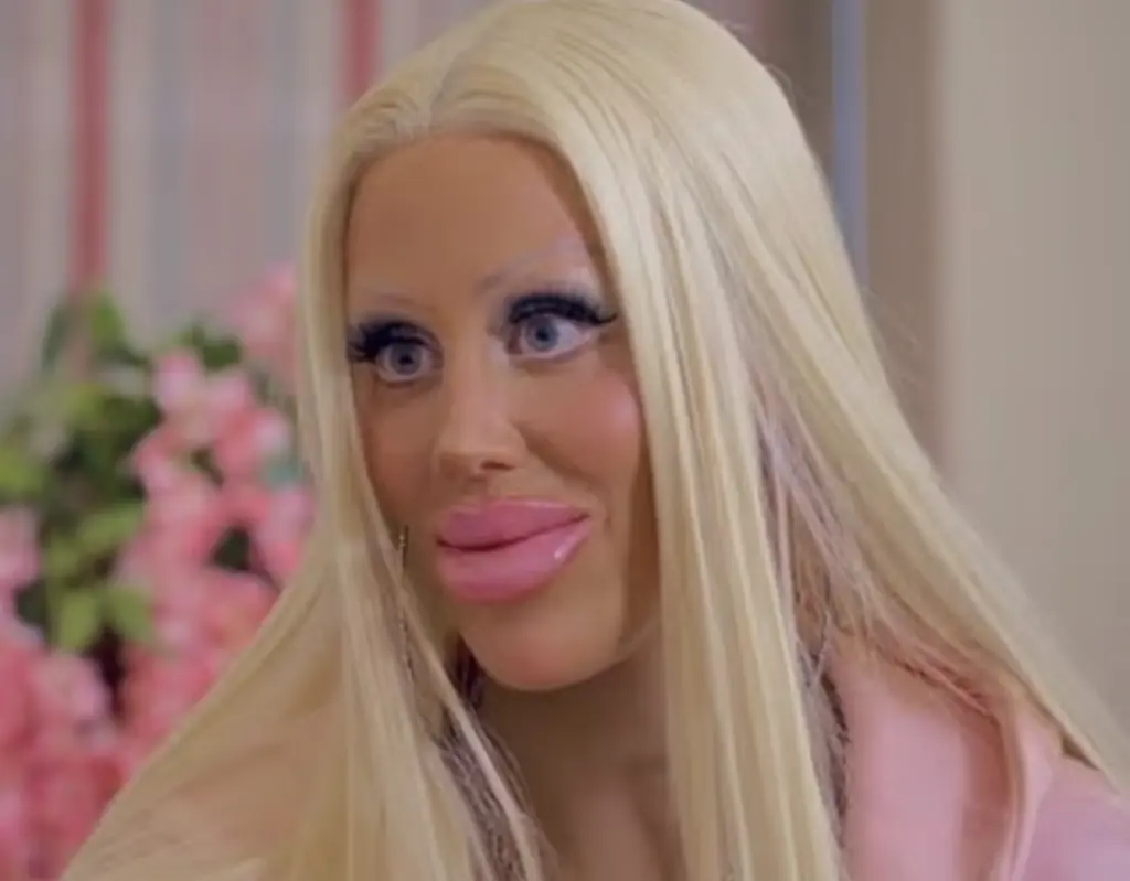 Alicia has spent hundreds of thousands of dollars on her appearance. Credit: ITV X / Olivia Attwood: The Price of Perfection