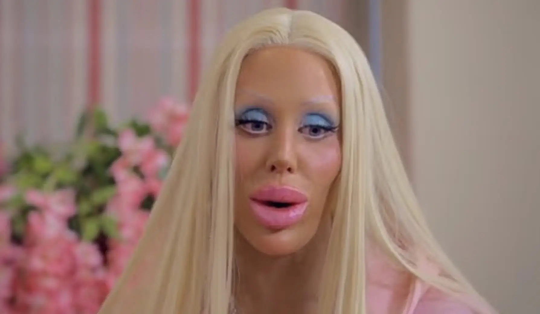 Woman who spent $320k on plastic surgery shows what she looked like before her transformation