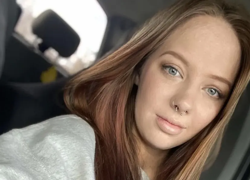 Woman who burned 40 percent of her body in fireball posts photo update of what she looks like six years on