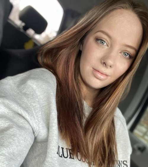 Woman who burned 40 percent of her body in fireball posts photo update of what she looks like six years on