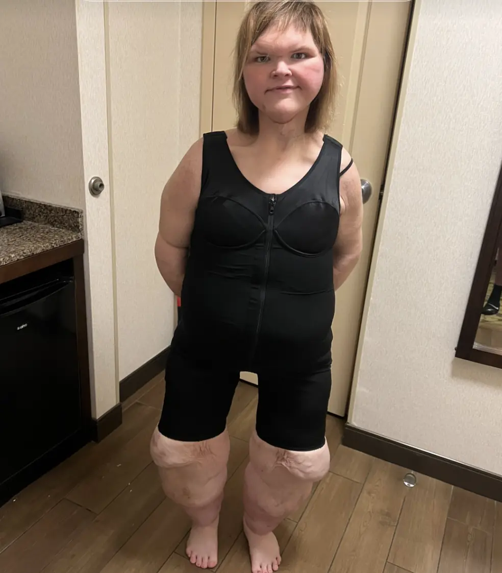 Tammy Slaton. Credit: TikTok