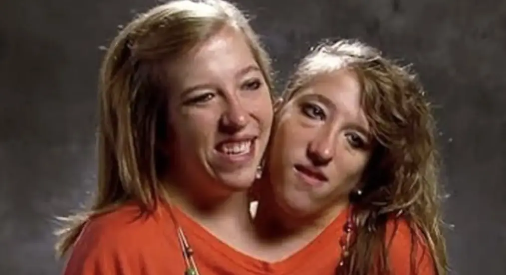 Major question answered about Abby and Brittany Hensel’s lives after one conjoined twin got married