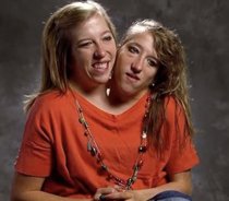Major question answered about Abby and Brittany Hensel’s lives after one conjoined twin got married