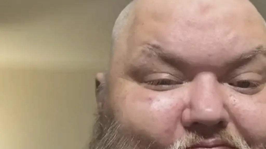 TikTok star John Crawley has died and his cause of death has been revealed