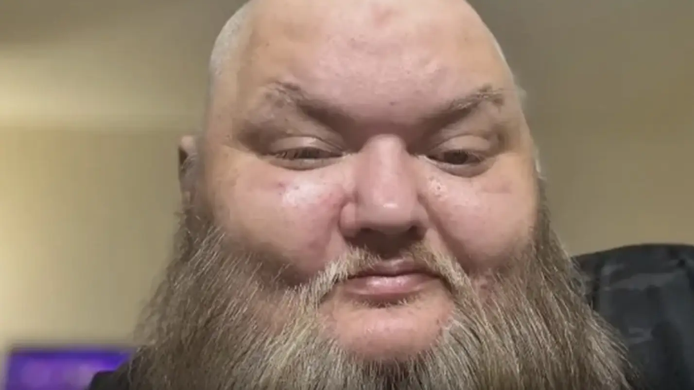 TikTok star John Crawley has died and his cause of death has been revealed