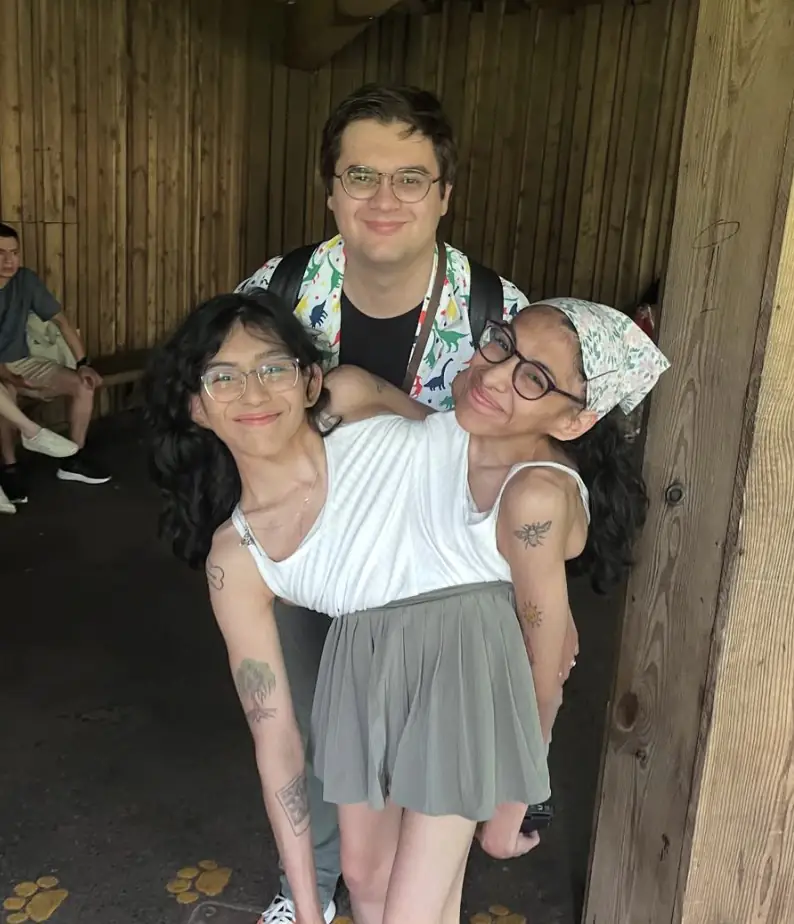 Conjoined twin and husband respond to sex question everyone is asking