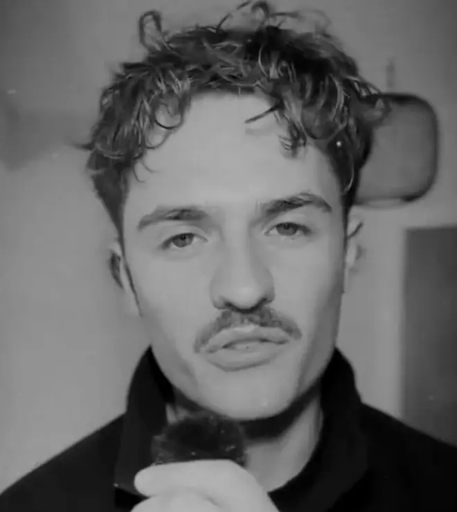 It's a stark warning to anyone who vapes. Credit: TikTok/@dralexlyons