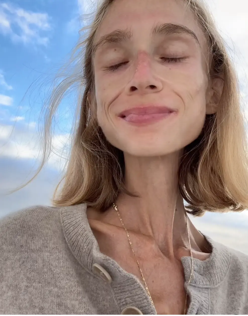 Karolina Krzyzak was just 19 when she began an experimental 'fruitarian' diet, eating nothing but raw fruits. Credit: Instagram