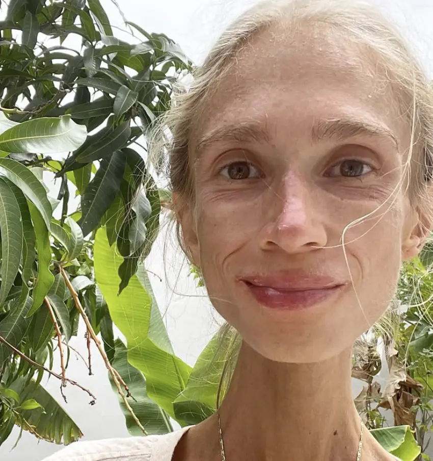 Brit student, 27, who adopted vegan ‘fruitarian’ diet starves to death in Bali hotel room weighing just 3.5 stone