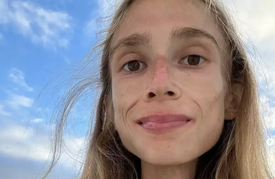 'Fruitarian' diet explained as Brit student, 27, starves to death in Bali hotel room weighing just 3.5 stone