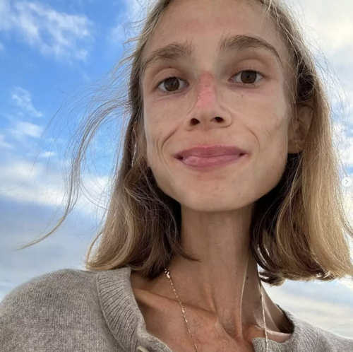 'Fruitarian' diet explained as Brit student, 27, starves to death in Bali hotel room weighing just 3.5 stone
