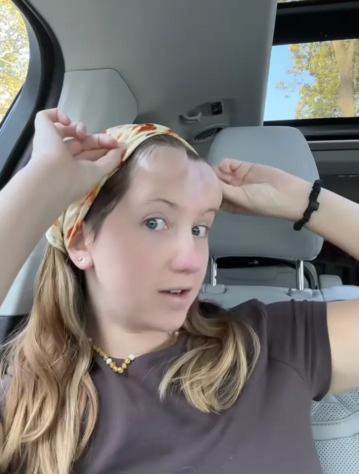 The woman is still facing years of further reconstructive surgery. Credit: @sincerelyjord / TikTok.