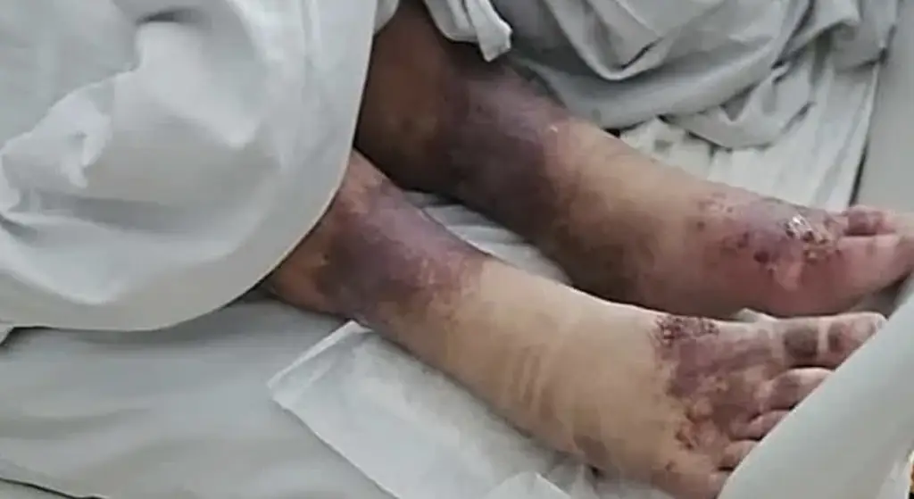 Authorities say Mirrella was days away from death. Credit: Pomagan.pl