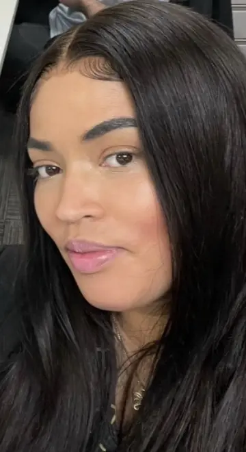 Stone died following a BBL. Credit: Fund the First