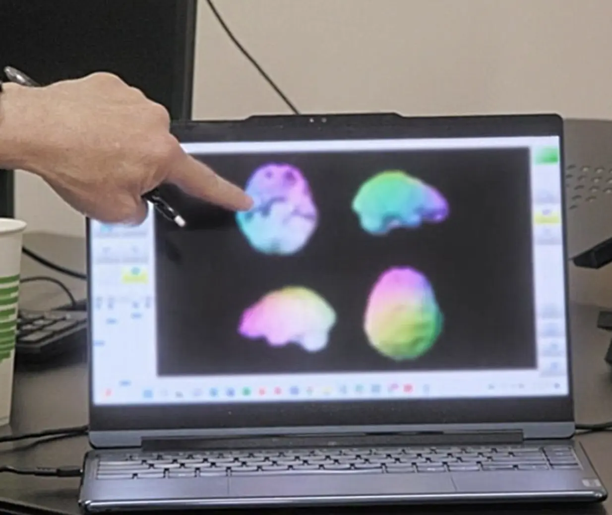 Kim Kardashian's brain scan.
Credit: Disney+