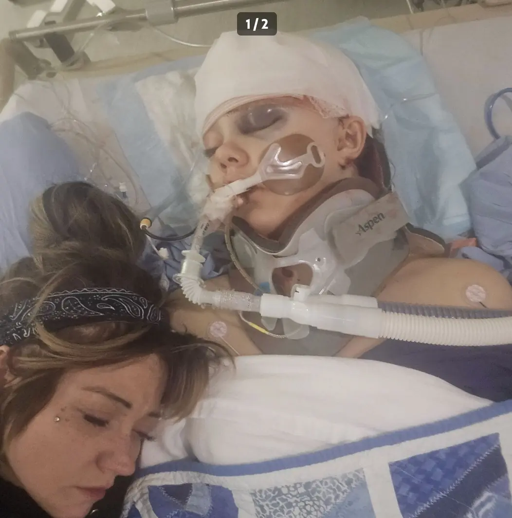 Maya remains in a critical condition. Credit: GoFundMe