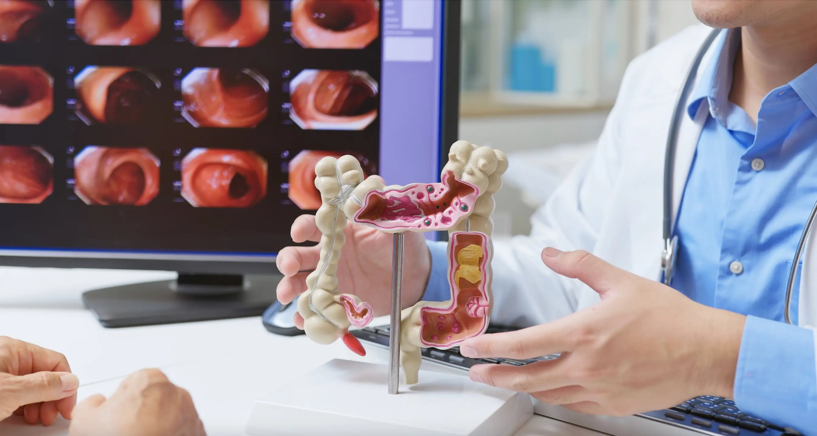 Colonoscopies can help with early detection. Credit: 	PonyWang/Getty Images