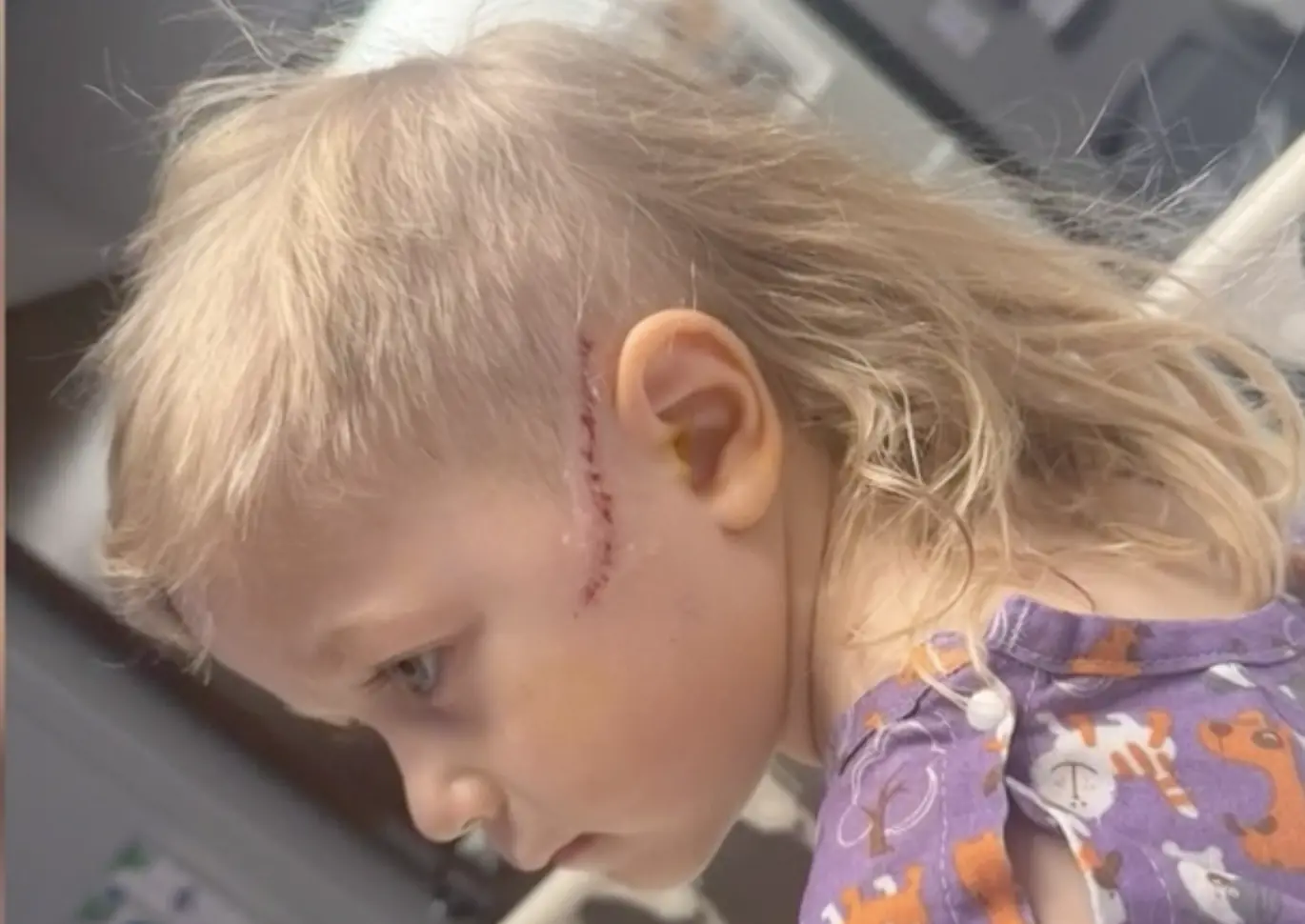 Cyler Hillman Injuries. Credit: Hillman Family