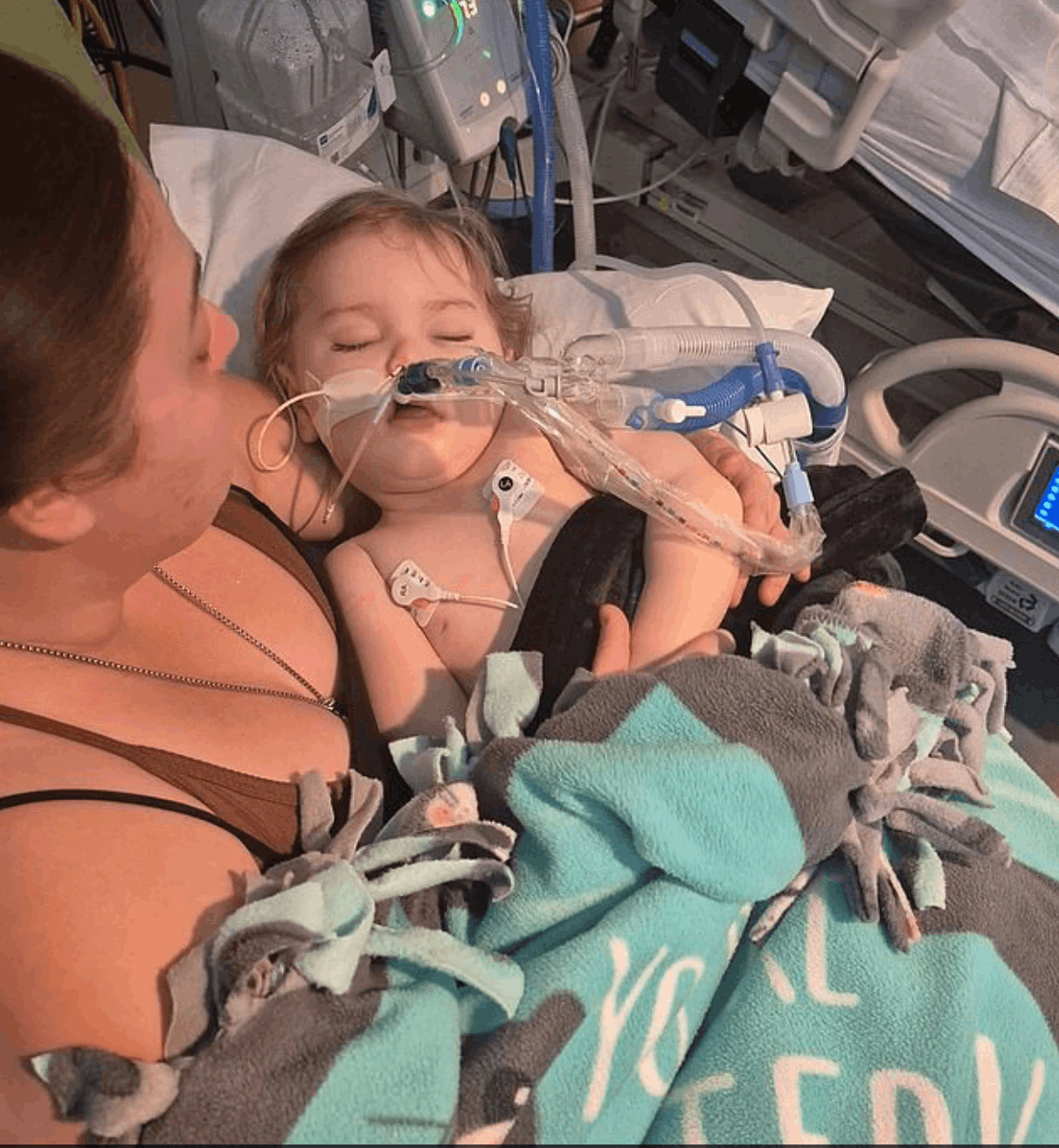One-year-old Alastor is set to be taken off life support on Friday. Credit: GoFundMe