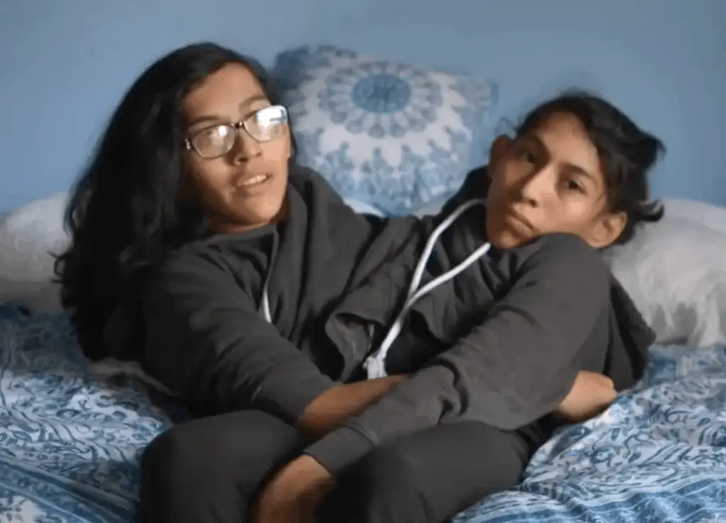 Carmen and Lupita are fairly open about how they navigate the challenges of being conjoined. Credit: The twins chose to stay conjoined to avoid any other health complications. Credit: YouTube/Channel 4 documentaries